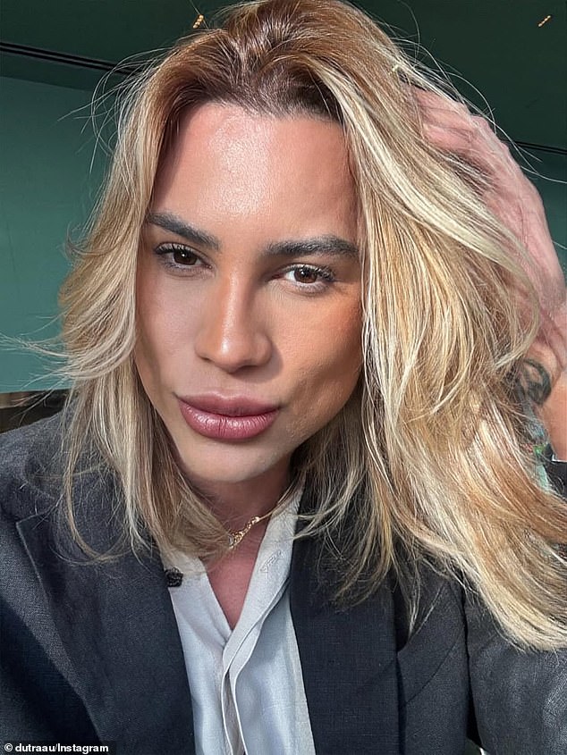 Influenceur de la mode brésilienne junior Duttra décède à l’âge de 31 ans après avoir soupçonné les complications du traitement « Fox Eye »
